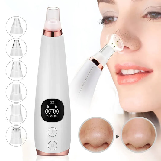 Blackhead Remover - Skin Care - 2