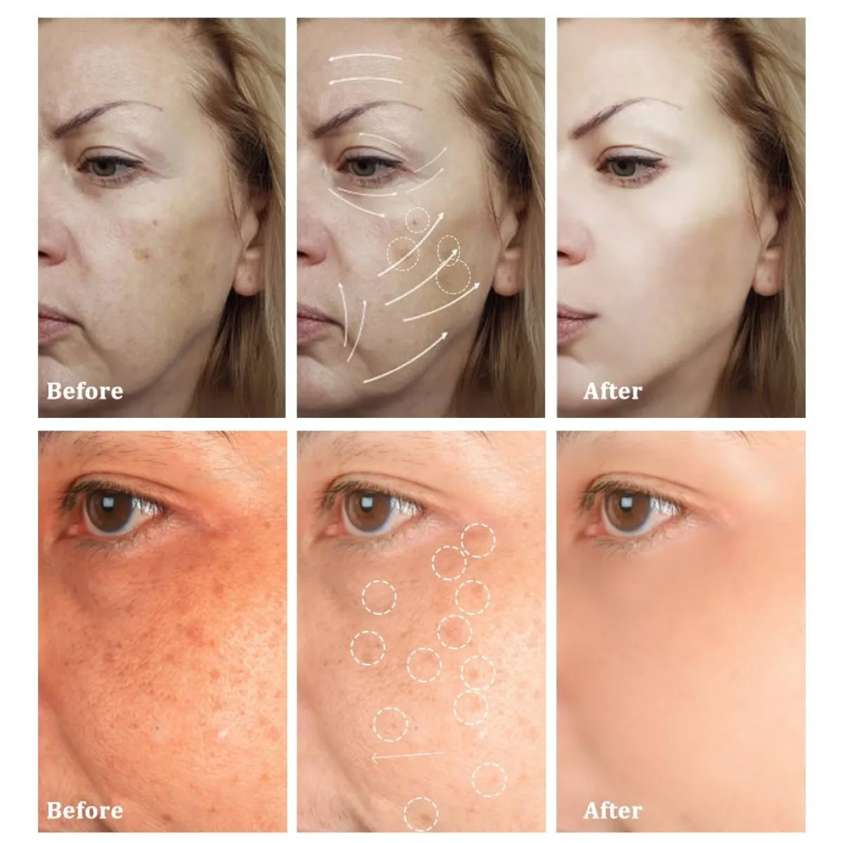 Nourishing Facial Snail Cream - Skin Care - 6