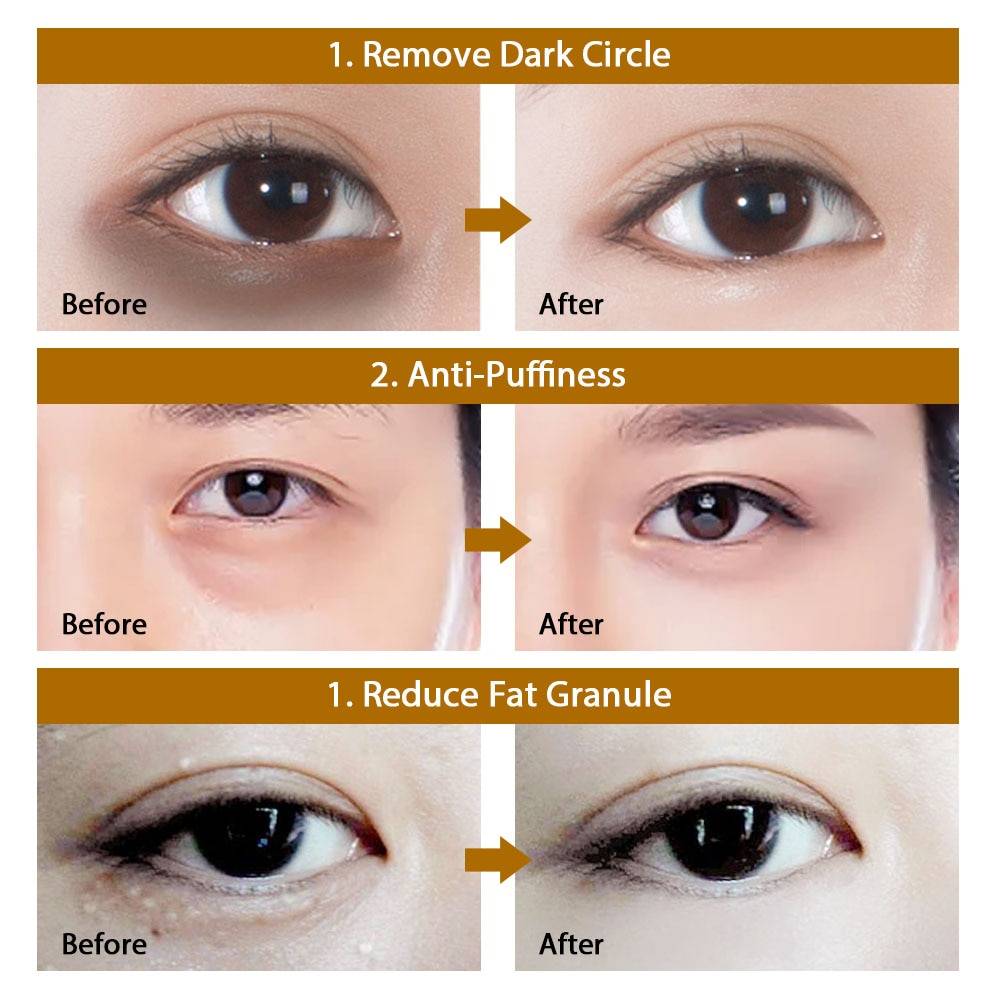 Intense Beauty Eye Patches - Skin Care - Health & Beauty - 15 - 2024