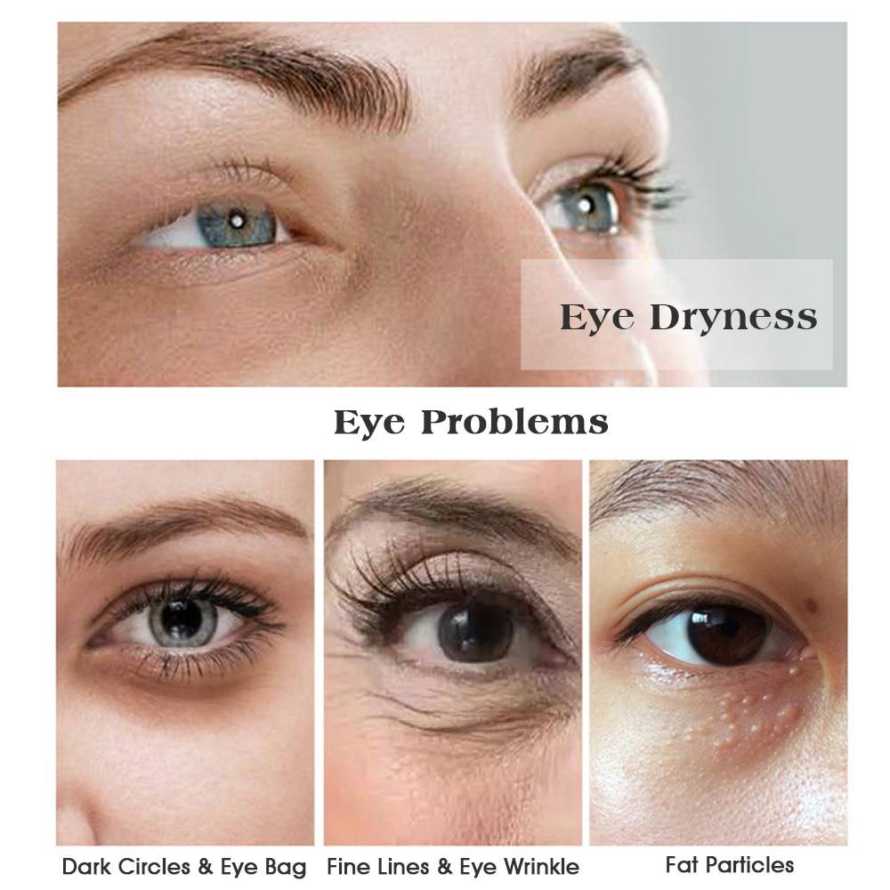 Intense Beauty Eye Patches - Skin Care - Health & Beauty - 7 - 2024