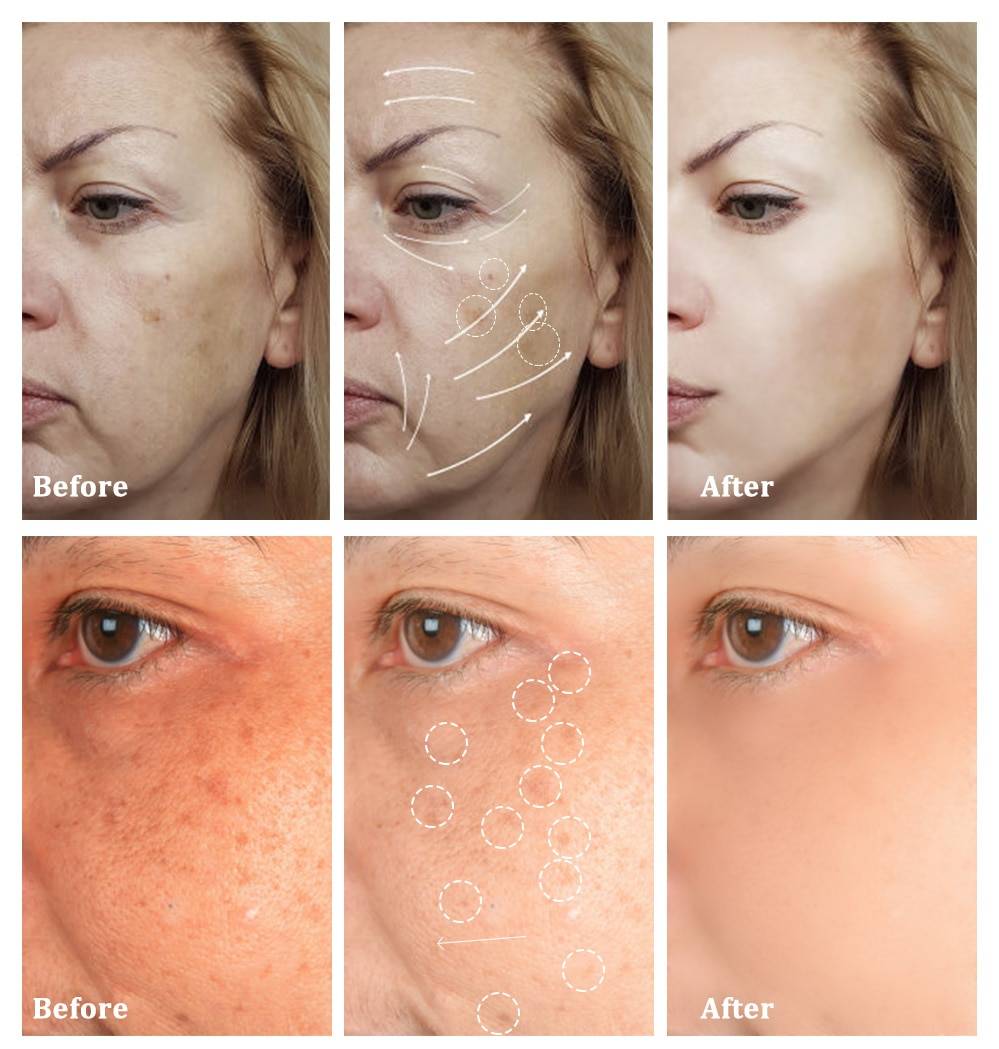 Nourishing Facial Snail Cream - Face Cream - Skin Care - Cosmetics - 6 - 2024