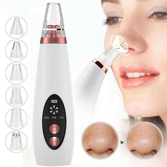 Face Pore Vacuum - Kawaii Stop - Beauty, Beauty &amp; Health, Blackhead Removal, Flawless Skin, Health, Pore, Remover, Skin, Skin Care, Vacuum